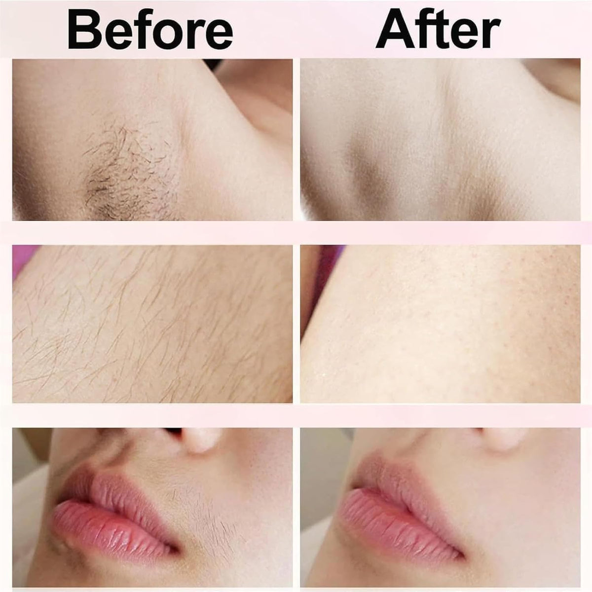 Bikini Trimmer for Women 2025 Upgrade Dual Head Shaver Women Ceramic Blades 2-in-1 Women's Body