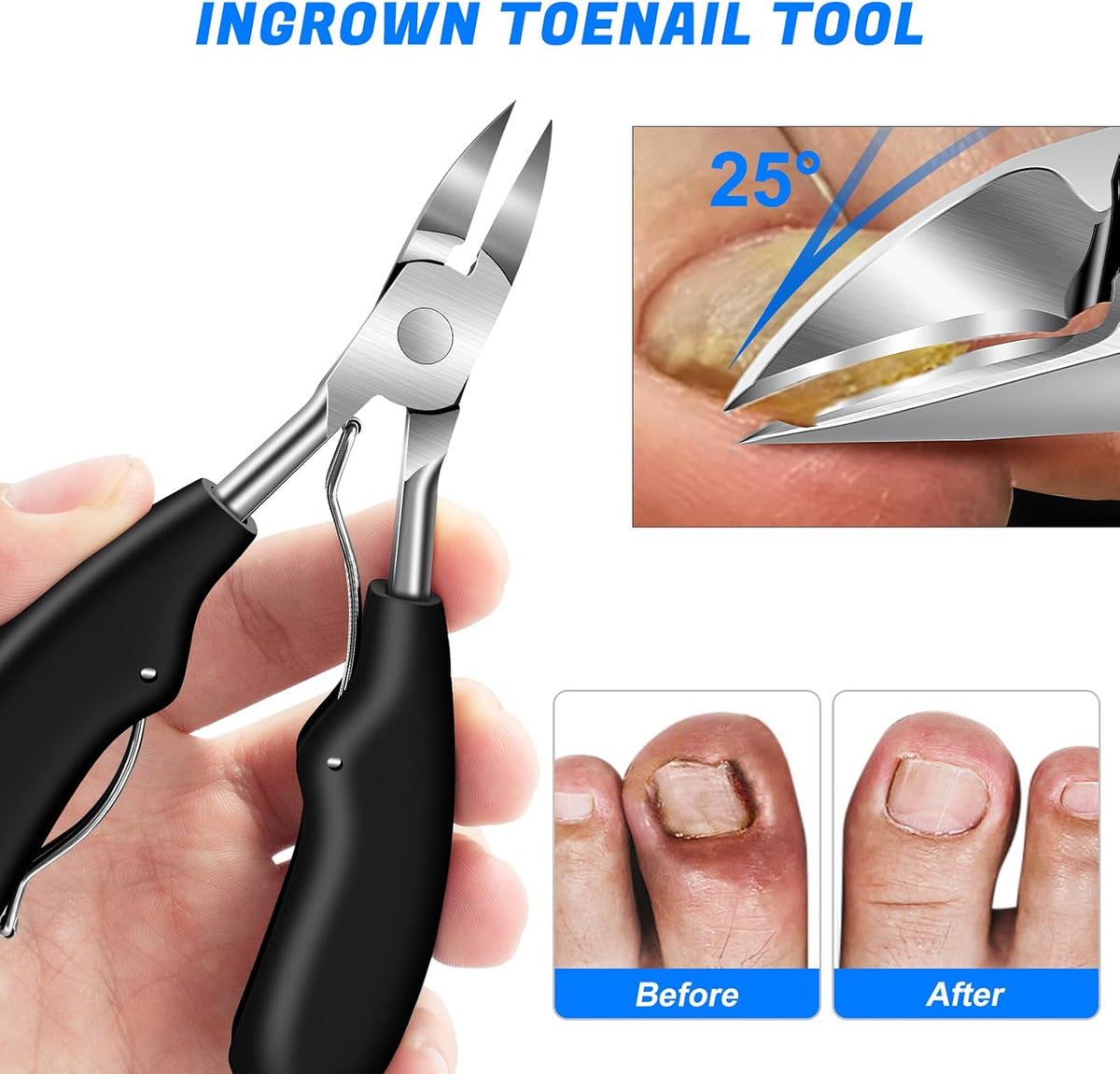Toenail Clippers for Seniors Ingrown Thick Toenails, 2025 Angled Head Toe Nail Clippers with